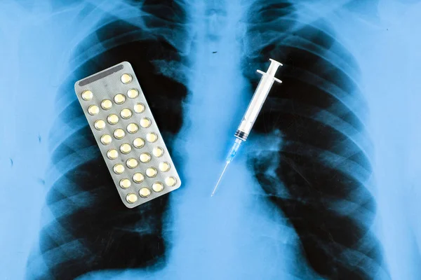 Tablets Blister Syringe Background Ray Lungs High Quality Photo — Stockfoto