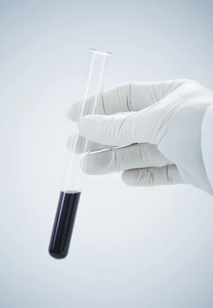Forskare håller blod i provrör. — Stockfoto
