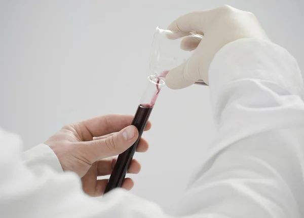 Scientist load a test tube with blood isolated. — Stock Photo, Image