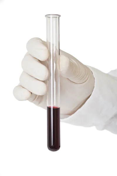 Forskare håller blod i provrör. — Stockfoto