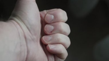 Tırnaklarında agnatik olan erkek el, görüntüyü kapat..