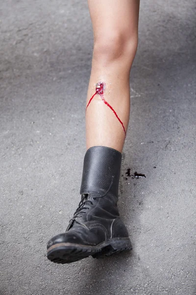 Огнестрельное ранение в ногу — стоковое фото