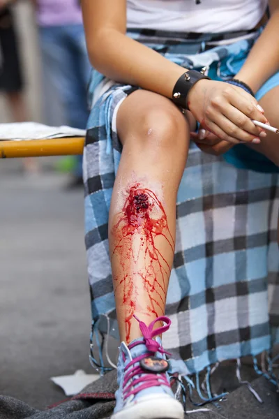 Lesión grave en la pierna de la niña — Foto de Stock