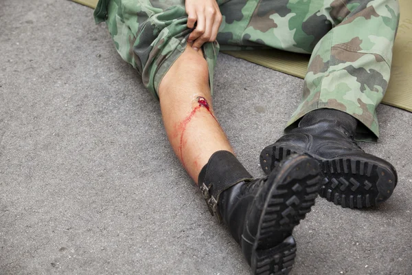 Ferimento de bala na perna do soldado — Fotografia de Stock