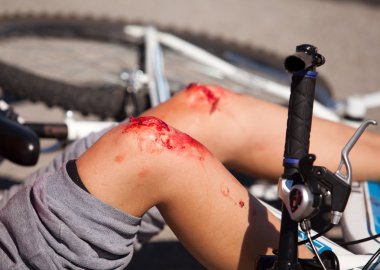 bike injuries clipart