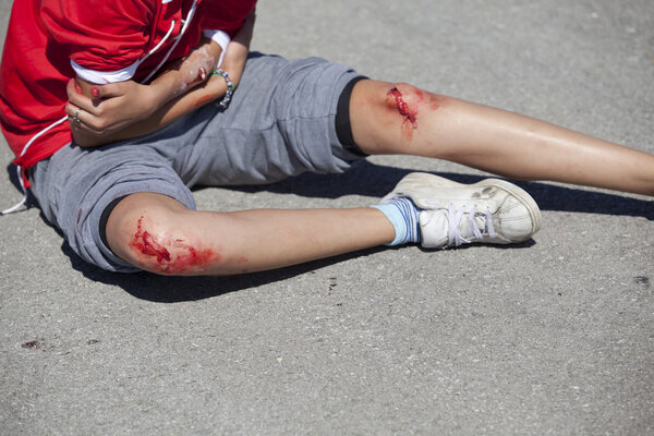 серьезные травмы ног и руки девушки
