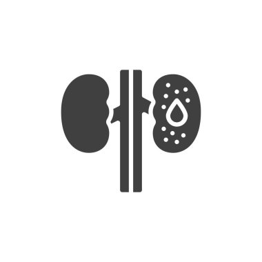 Diabetic kidney disease vector icon. filled flat sign for mobile concept and web design. Diabetic nephropathy glyph icon. Symbol, logo illustration. Vector graphics