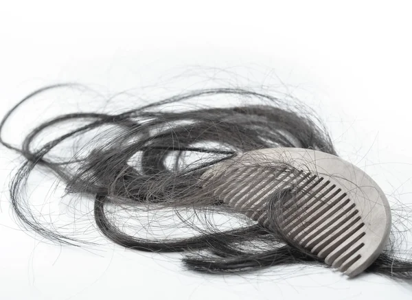 Hair loss problem — Stock Photo, Image