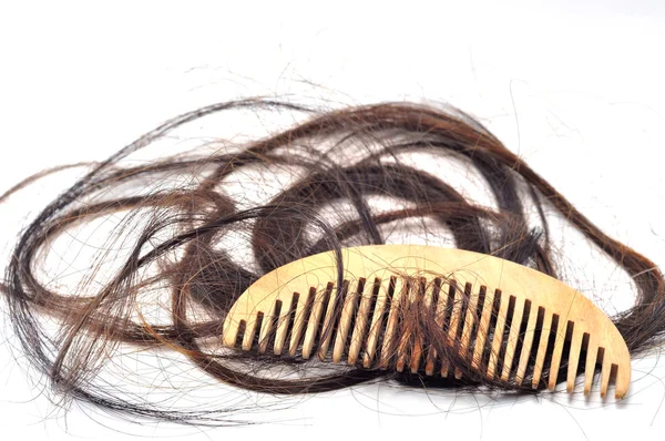 Saç dökülme problemi — Stok fotoğraf