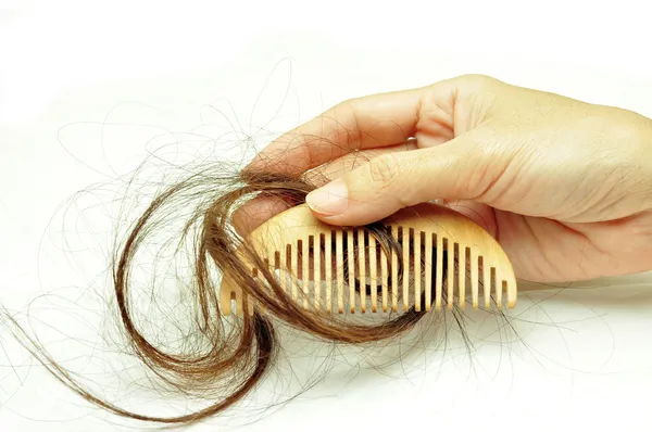 Проблема выпадения волос — стоковое фото