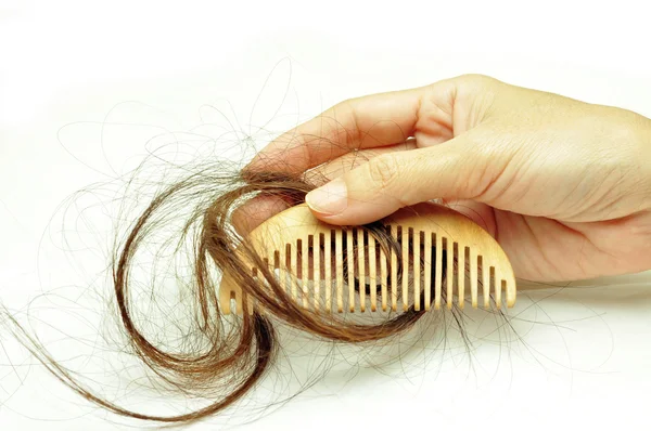 Hair loss problem — Stock Photo, Image