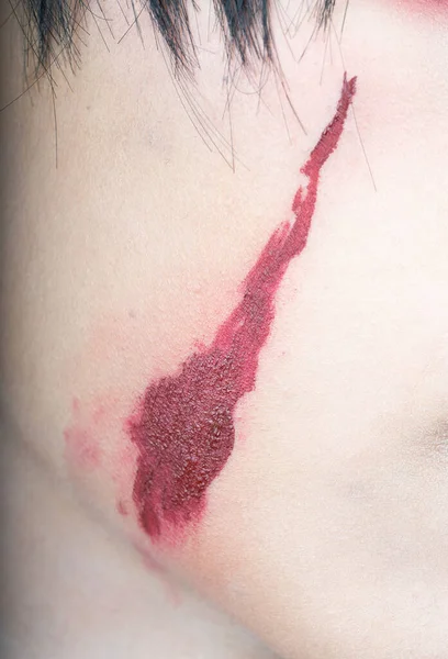 受伤人类皮肤的血 — 图库照片