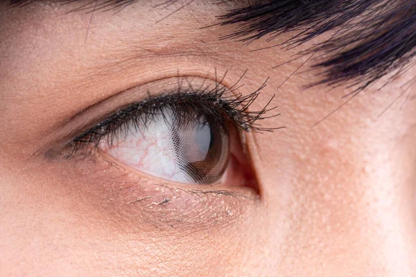 Pupil Eye Colored Contacts — Stock Photo, Image