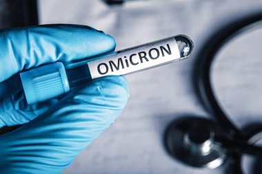 Doktor elinde yeni bir Coronavirus mutasyonu örneği olan bir tüp tutuyor. Yeni covid-19 varyant omikron.