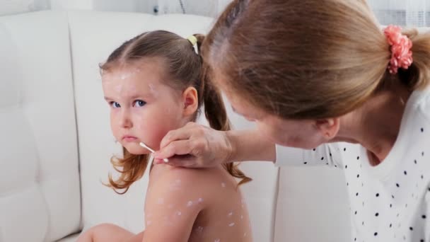 Mother treats the rash on the body of a little girl 3-4 years old with antiseptic ointment at home, the symptoms and treatment of the chickenpox viral disease. — Stock Video