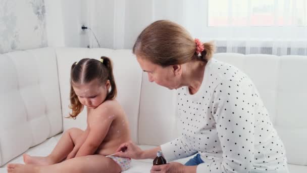 Anne, 3-4 yaşlarındaki küçük bir kızın vücudundaki kızarıklıkları evde antiseptik merhemle tedavi ediyor. Suçiçeği virüsünün semptomları ve tedavisi.... — Stok video