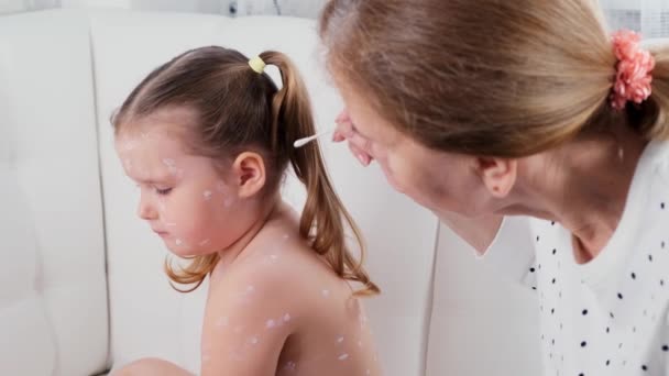 Bambina con varicella, crema antisettica applicata all'eruzione cutanea. Madre che applica la crema antisettica sulla bambina triste con la varicella a casa — Video Stock