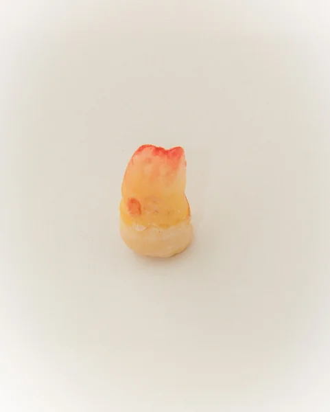 Wisdom tooth — Stock Photo, Image