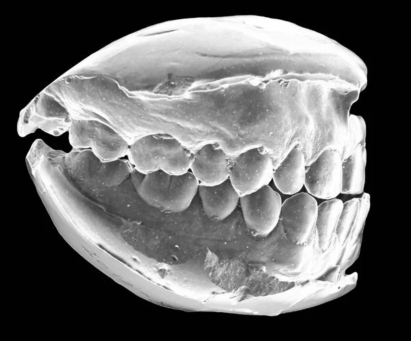 Diş dökme, sol tarafta, perspektif