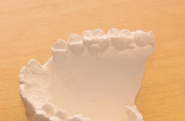 Diş Ortodonti ve eğitim için döküm