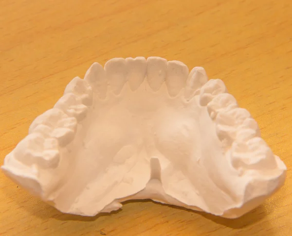 Diş Hekimliği eğitim için döküm — Stok fotoğraf