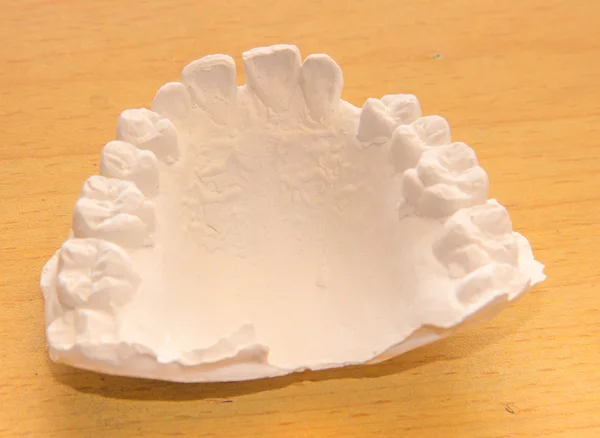 Important part of dental cast — Stock Photo, Image