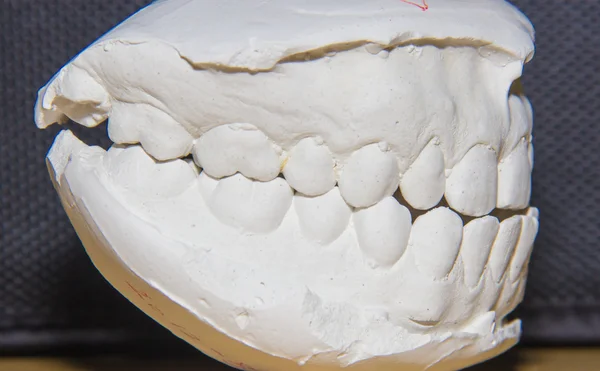 Diş dökme, sol tarafta