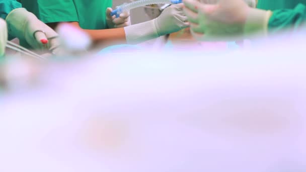 Close up de uma tesoura cirúrgica ao lado de um paciente — Vídeo de Stock