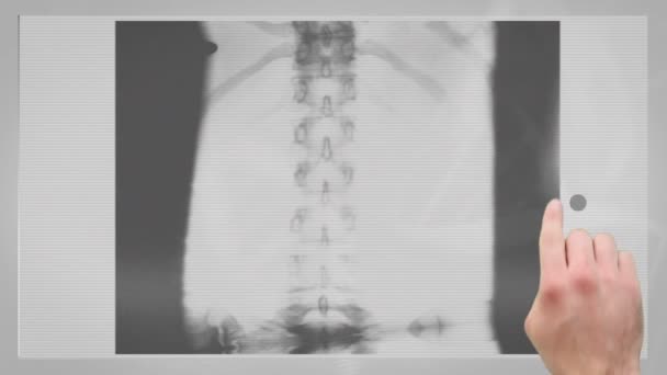 Montaje de rayos X — Vídeo de stock
