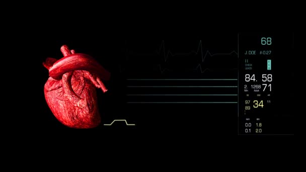 Vídeo de un electrocardiograma — Vídeo de stock