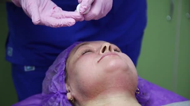 Eine Frau liegt auf einer Couch im Büro eines Dermatologen und erhält einen kosmetischen Eingriff. CO2-Zerkleinerung — Stockvideo