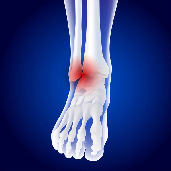 Educational Medical Illustration Foot Bones — Stock Vector