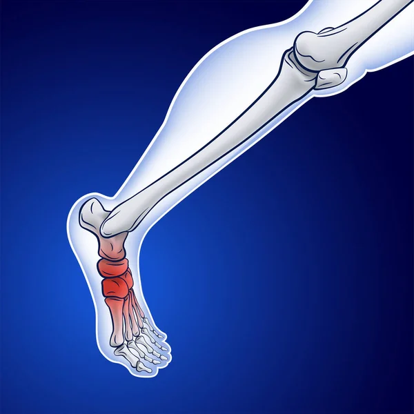 Illustration Running Skeletal Line Showing Red Dot Indicating Injury — Stock vektor