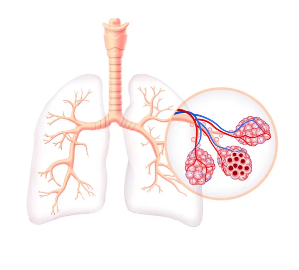 Diagrama Que Muestra Tráquea Sana Los Sacos Aire Los Pulmones — Vector de stock