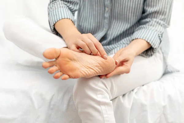 Woman touch the dry cracked skin of her feet with her hands while sitting on white bed at home. Peeling, cracks sole and heels. Dryness, dermatitis, dehydration, eczema, psoriasis, skincare.