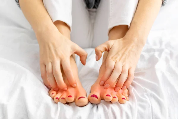 Woman hands scratch her legs sitting on white bed at home. Itchy skin, redness, fungus, redness, bacterial infection, allergic reaction, eczema, dermatitis of the foot. Health and skincare concept.