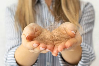 Kadın ellerinin birbirine dolanmış saçlarını tuttuğu yakın plan. Saç dökülmesi, stres, hormonal dengesizlik, sağlıksız beslenme, vitamin eksikliği. Kel kalmaktan korkan tanınmamış sarışın kadın..