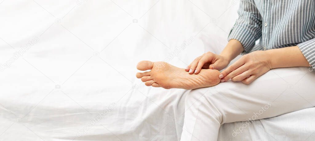 Woman touch the dry cracked skin of her leg with her hands while sitting on white bed. Peeling, cracks sole of the feet and heels. Dryness, dermatitis, dehydration, eczema, health care. Copy space.