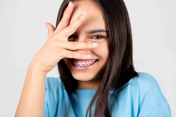 Ashamed Funny Teen Girl Braces Covering Face Hand Isolated White — Stockfoto