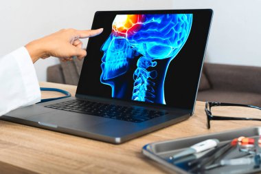 Doctor showing a x-ray of pain in the brain. Migraine Headache concept. High quality photo