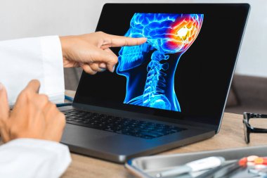 Doctor showing a x-ray of pain in the brain. Migraine Headache concept. High quality photo