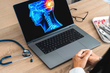 Doctor looking a x-ray of pain in the brain on a laptop. Migraine Headache. High quality photo