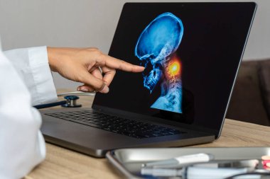 Doctor showing a x-ray of pain in the brain. Migraine Headache concept. High quality photo