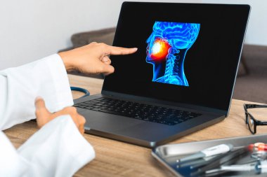 Dentist showing a x-ray of pain in the mouth. . High quality photo