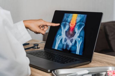 Doctor looking a x-ray of pain in the spine. Backache trauma. High quality photo