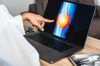 Close up of doctor showing a x-ray of pain in the knee. High quality photo