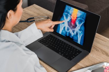 Doctor looking a x-ray of pain in the spine. Backache trauma. High quality photo