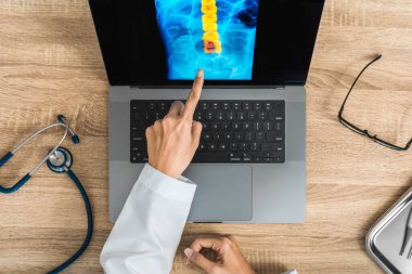 Top view of doctor looking a x-ray of pain in the spine. Backache trauma. High quality photo