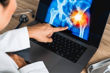 Doctor showing a x-ray of pain in the hips on a laptop. . High quality photo