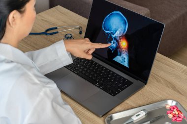 Doctor showing a x-ray of pain in the brain. Migraine Headache concept. High quality photo